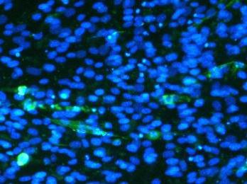 Mioblasty myszy w odpowiednich warunkach różnicują do włókien mięśniowych, wykazujących ekspresję miozyny (wydłużone, zielone komórki).