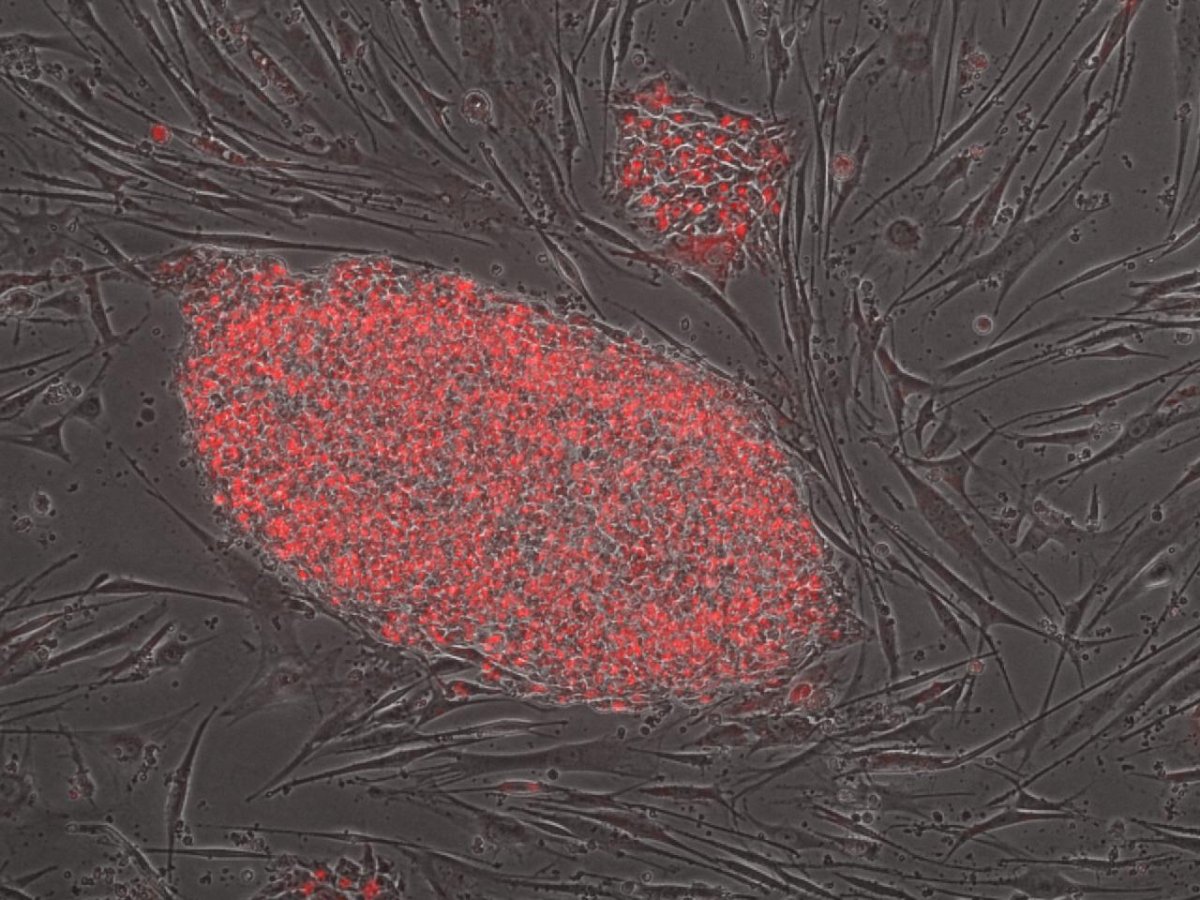 Kolonie ludzkich iPSC, rosnące na podłożu innych komórek, tworzących tzw. warstwę odżywczą. Komórki iPS charakteryzują się obecnością charakterystycznych markerów (uwidocznionych kolorem czerwonym)