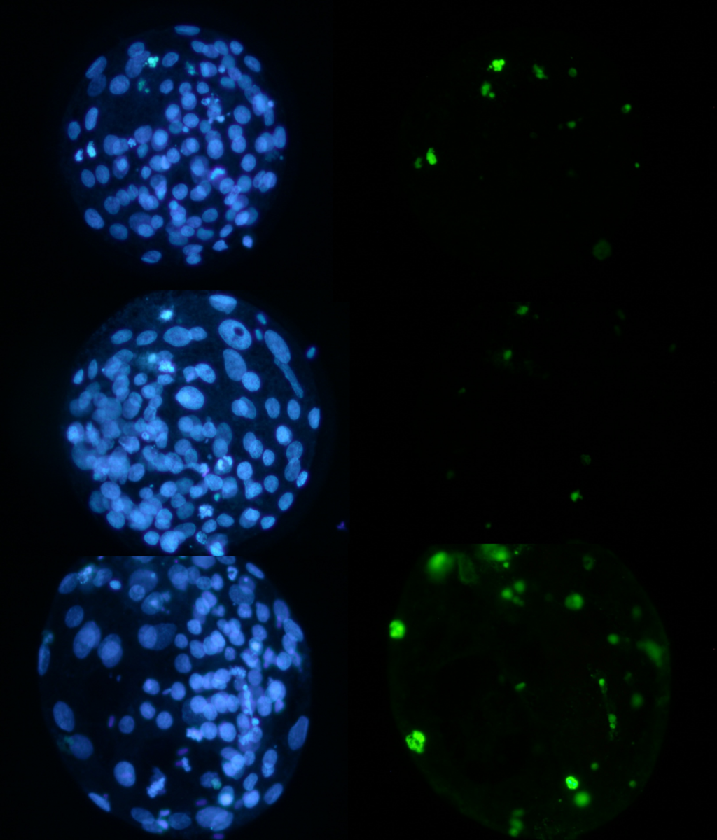 Trzy blastocysty bydlęce po reakcji TUNEL wykonanej w celu oceny jakości zarodków uzyskanych w wyniku zapłodnienia in vitro - na niebiesko wybarwione zostały wszystkie jądra komórkowe zarodka natomiast na zielono jądra komórek blastocysty które uległy fragmentacji DNA