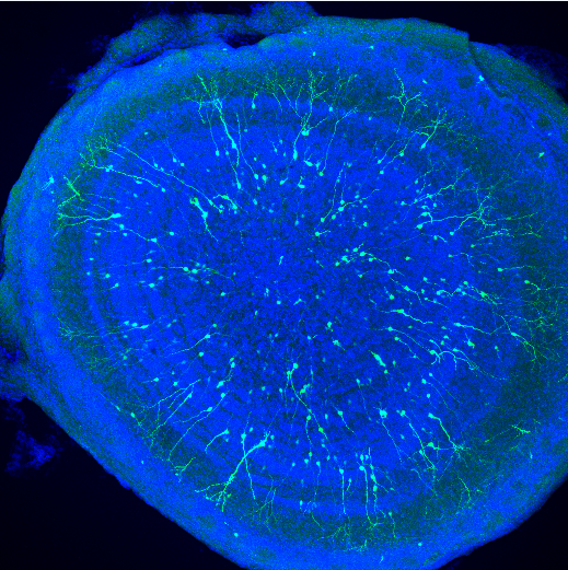 Zdjęcia mikroskopowe przedstawiające zróżnicowane neurony w opuszce węchowej, skrawek poprzeczny mózgu myszy. Kolor zielony: neurony eksprymujące białko EGFP, niebieski: jądra komórek (Hoechst).