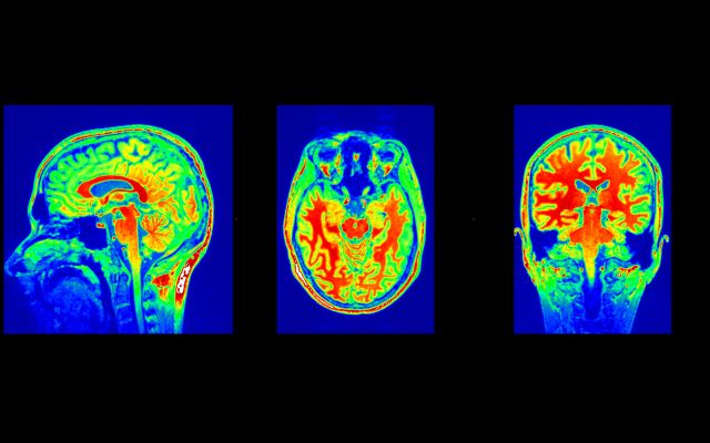 Obrazy anatomiczne ludzkiego mózgu uzyskane za pomocą rezonansu magnetycznego