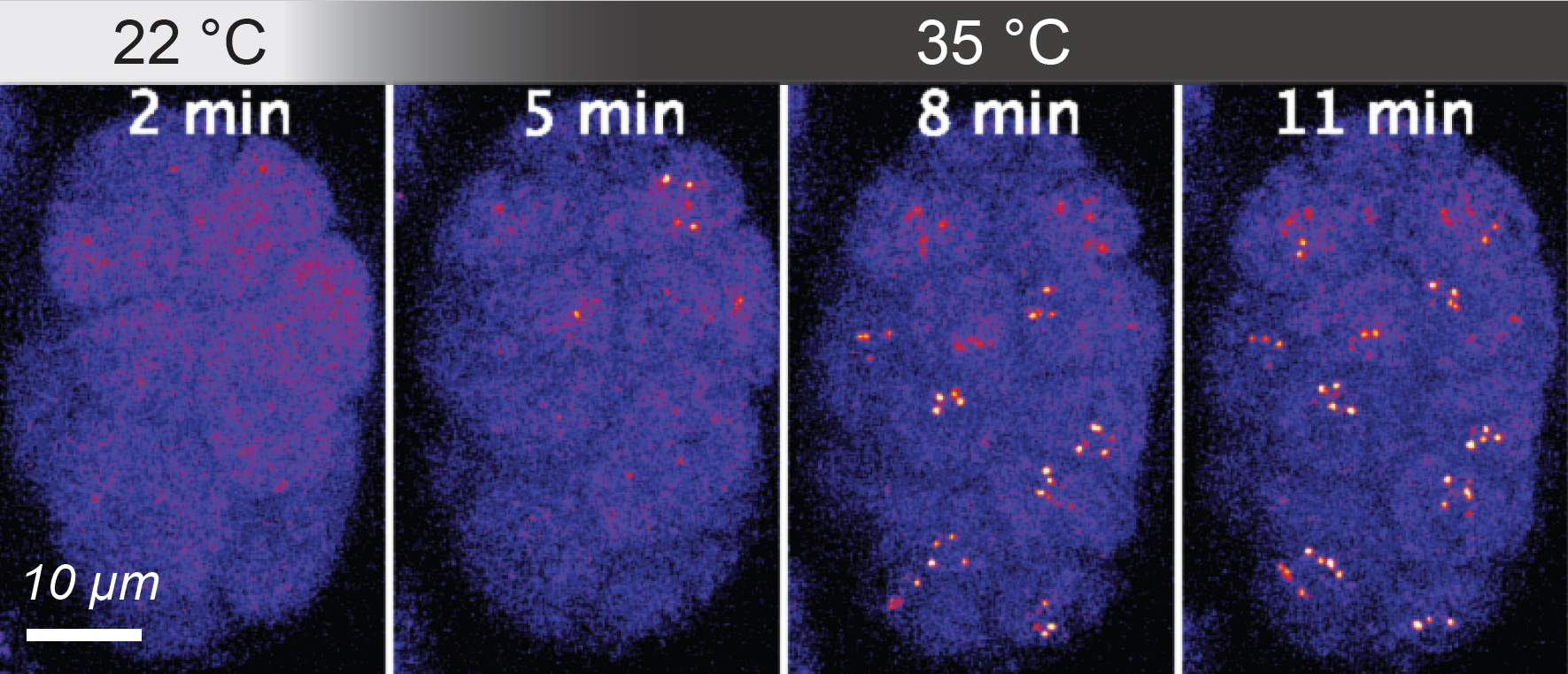 Kondensaty białkowe tworzone przez czynnik transkrypcyjny HSF-1 w jądrach komórek wczesnego embrionu C. elegans pod wpływem stresu termicznego, fot. A. Kłosin